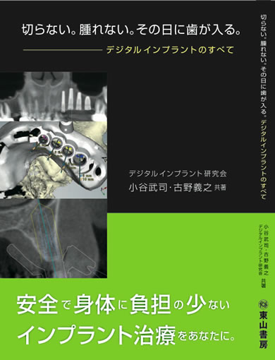 宇部市歯科医院のあいおい歯科・インプラント矯正クリニックデジタルインプラントのすべて